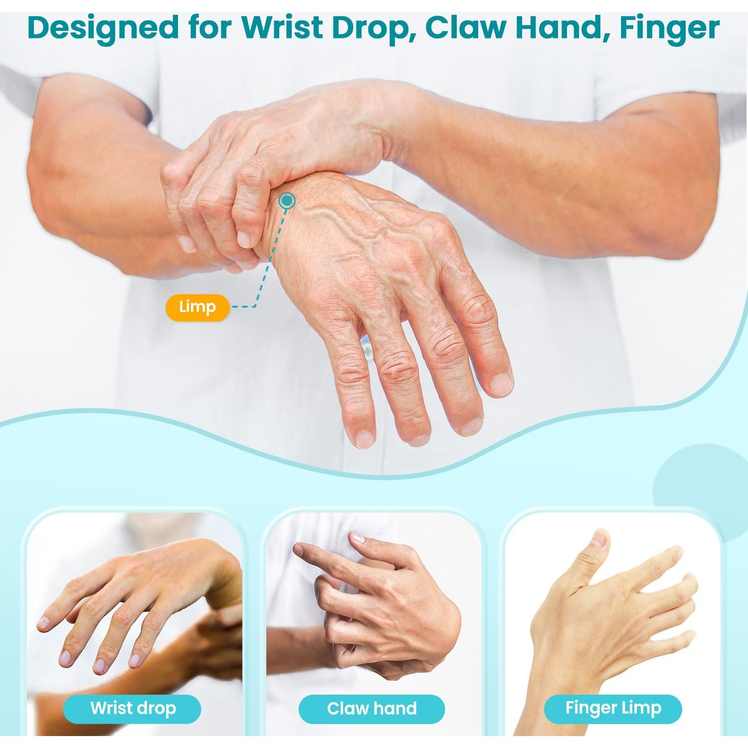 Férula para Parálisis del Nervio Radial DrFinger - Beige, Ajustable