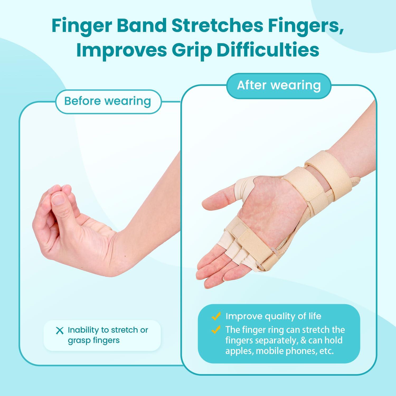 Férula para Parálisis del Nervio Radial DrFinger - Beige, Ajustable