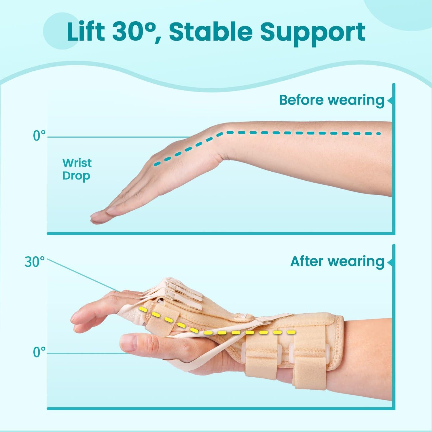 Férula para Parálisis del Nervio Radial DrFinger - Beige, Ajustable