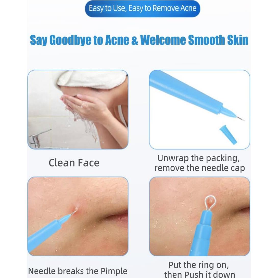 Paquete de 2 Herramientas Desechables Estériles BeiLaiSun para Eliminar Acné