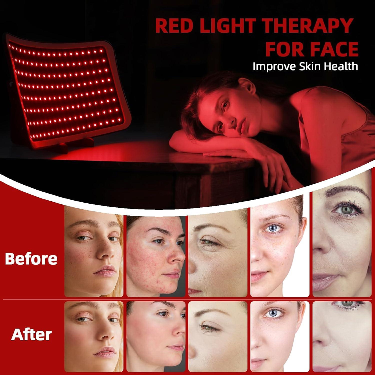 Lámpara de Terapia de Luz Roja Veefy 4-en-1 660nm y 850nm