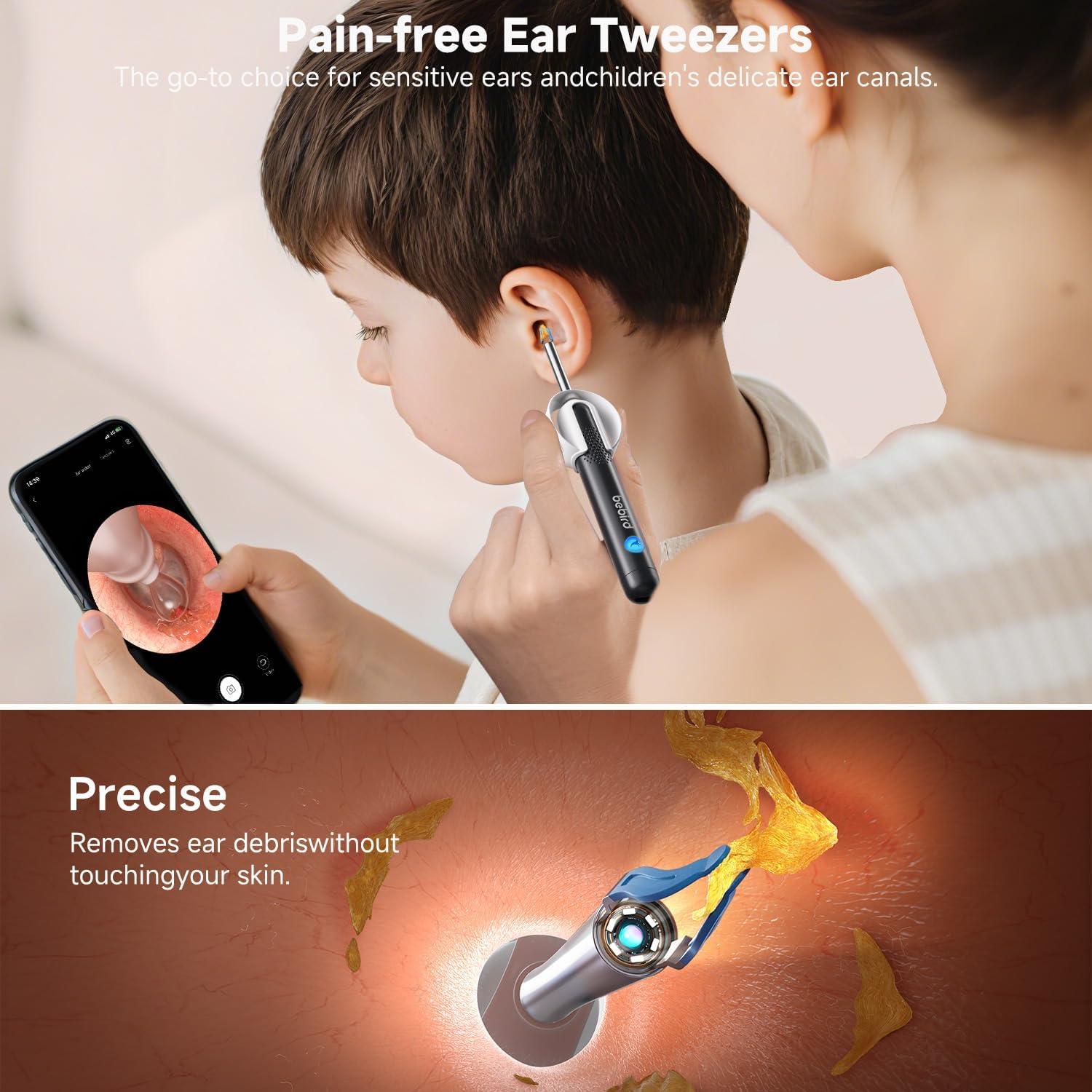 Limpiador de Oído Bebird R1 Ultra con Cámara y Pinzas