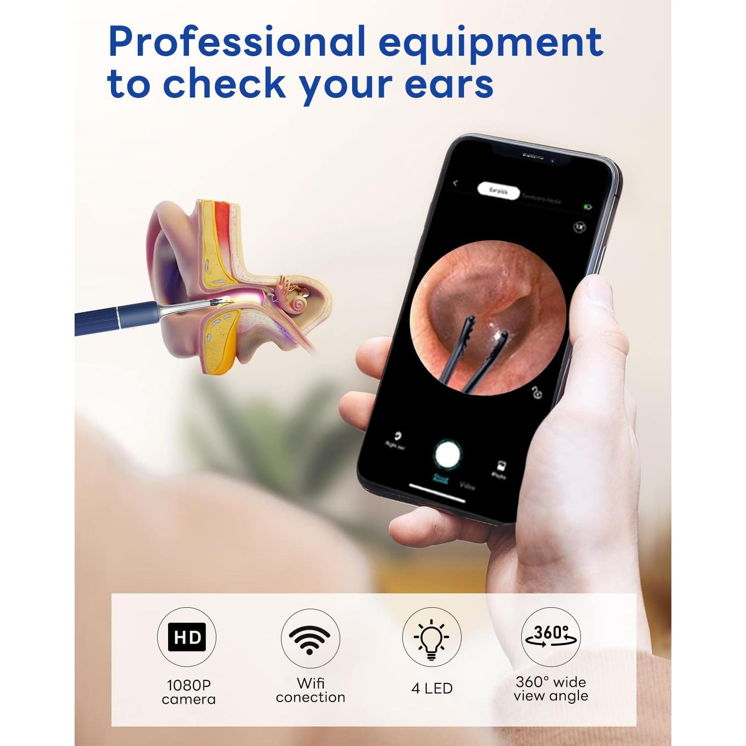 Kit de Eliminación de Cera de Oído MEKK S5 - Visual HD 1080P