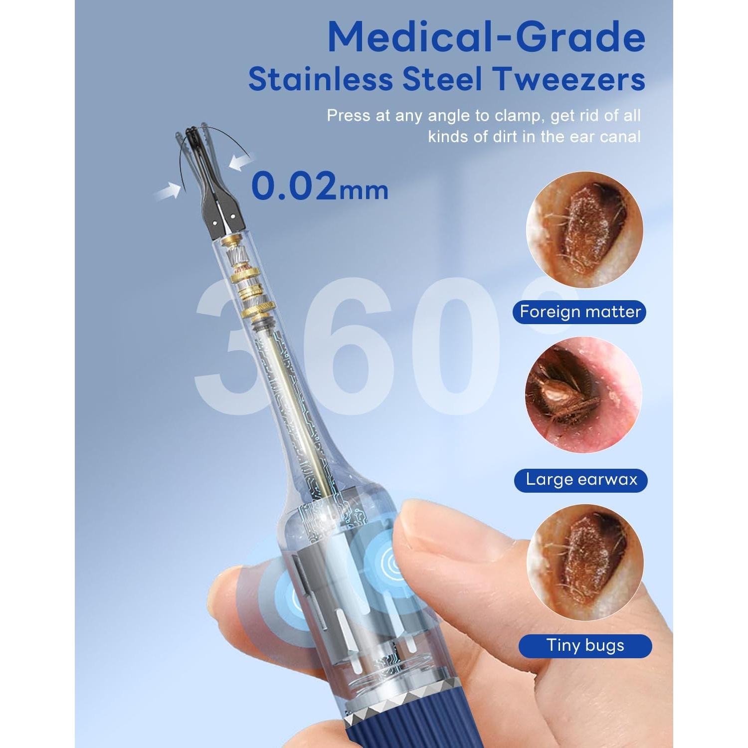 Kit de Eliminación de Cera de Oído MEKK S5 - Visual HD 1080P