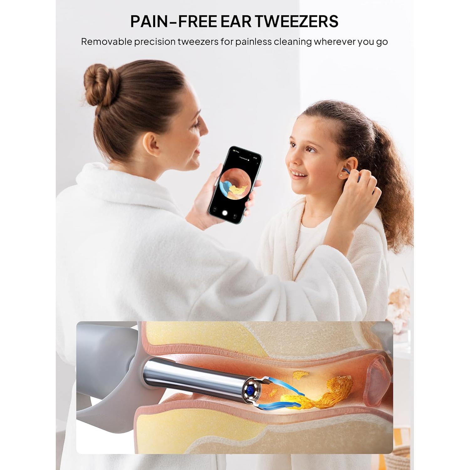 Limpiador de Oídos Inalámbrico Yumika con Cámara HD 1080P