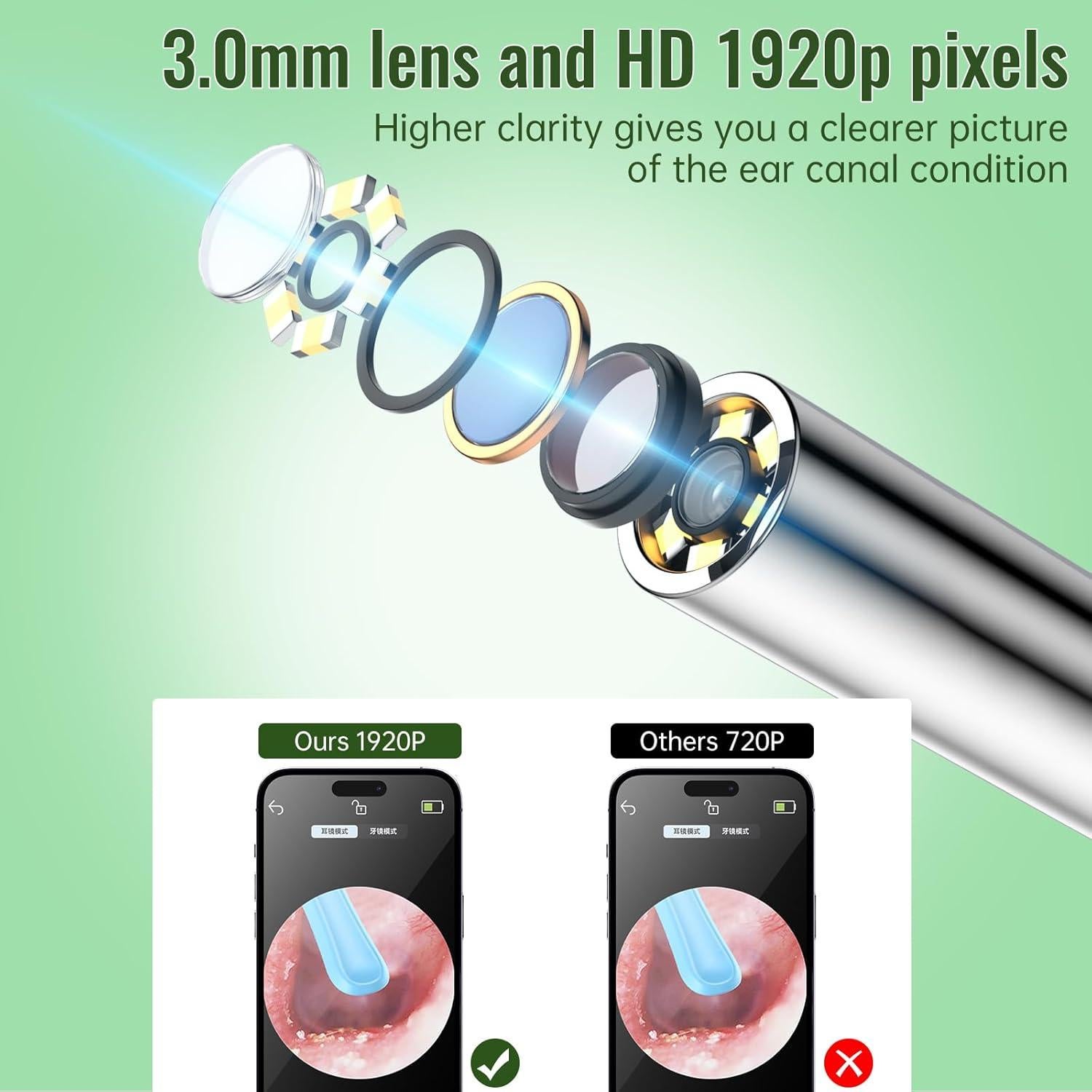 Kit de Limpieza de Oídos ALIANSHENG con Cámara HD 1920P