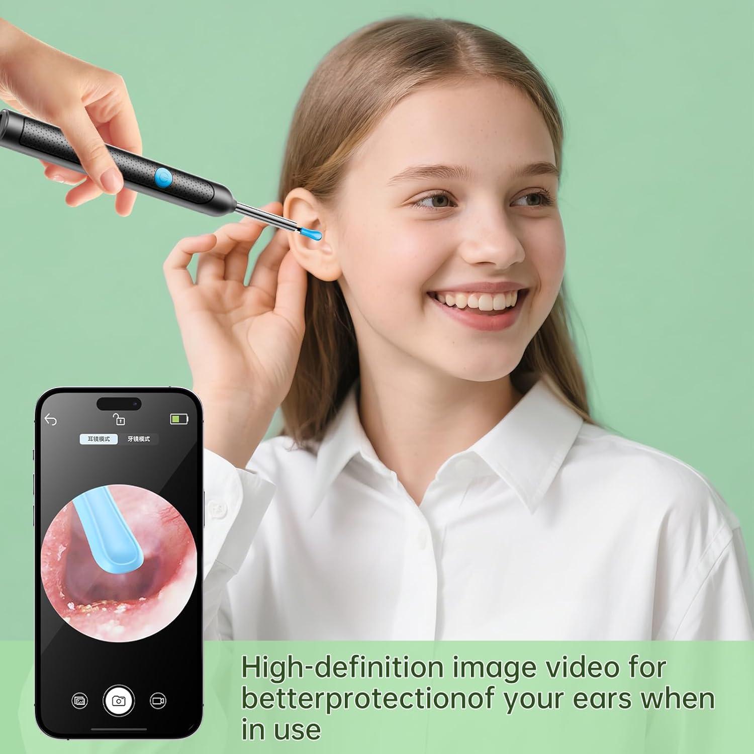 Kit de Limpieza de Oídos ALIANSHENG con Cámara HD 1920P