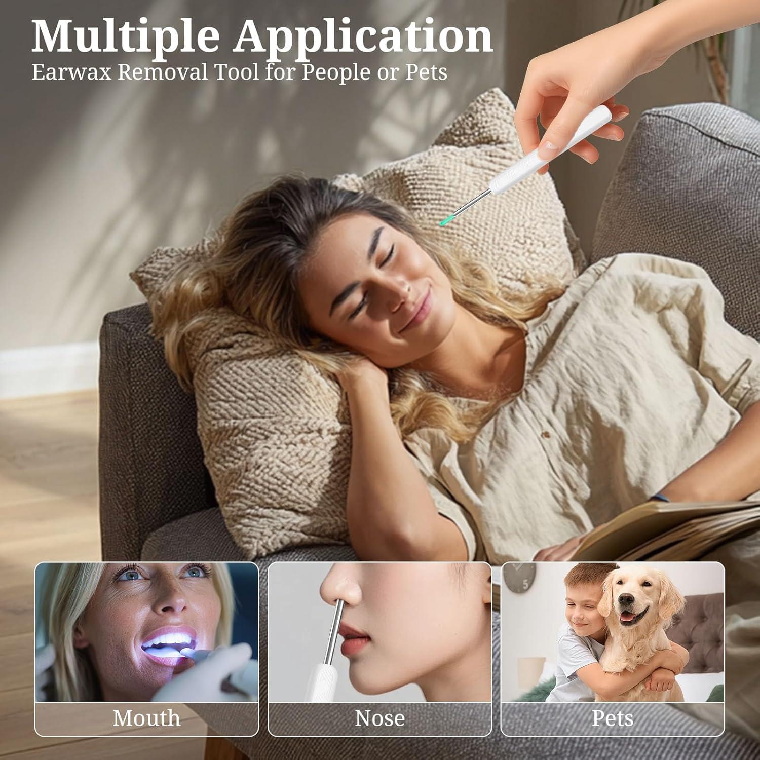 Limpiador de Oídos Recargable Fjordiony con Cámara HD 1080P