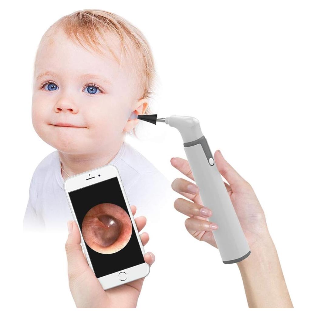 Otoscopio Inalámbrico ScopeAround HD 720P con Luz LED y Giroscopio