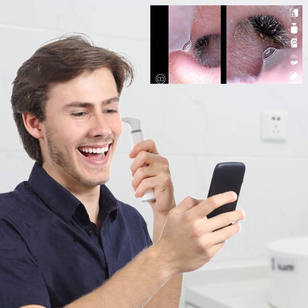 Otoscopio Inalámbrico ScopeAround HD 720P con Luz LED y Giroscopio