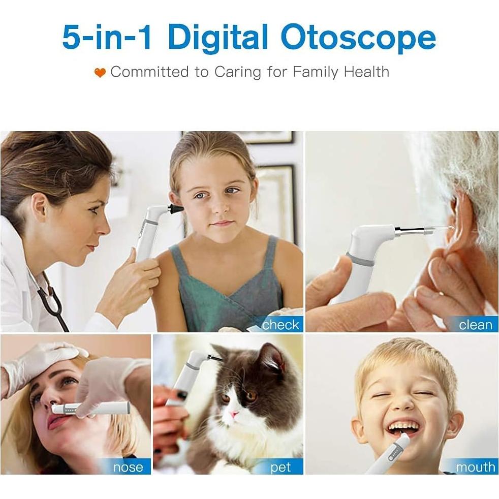 Otoscopio Inalámbrico ScopeAround HD 720P con Luz LED y Giroscopio