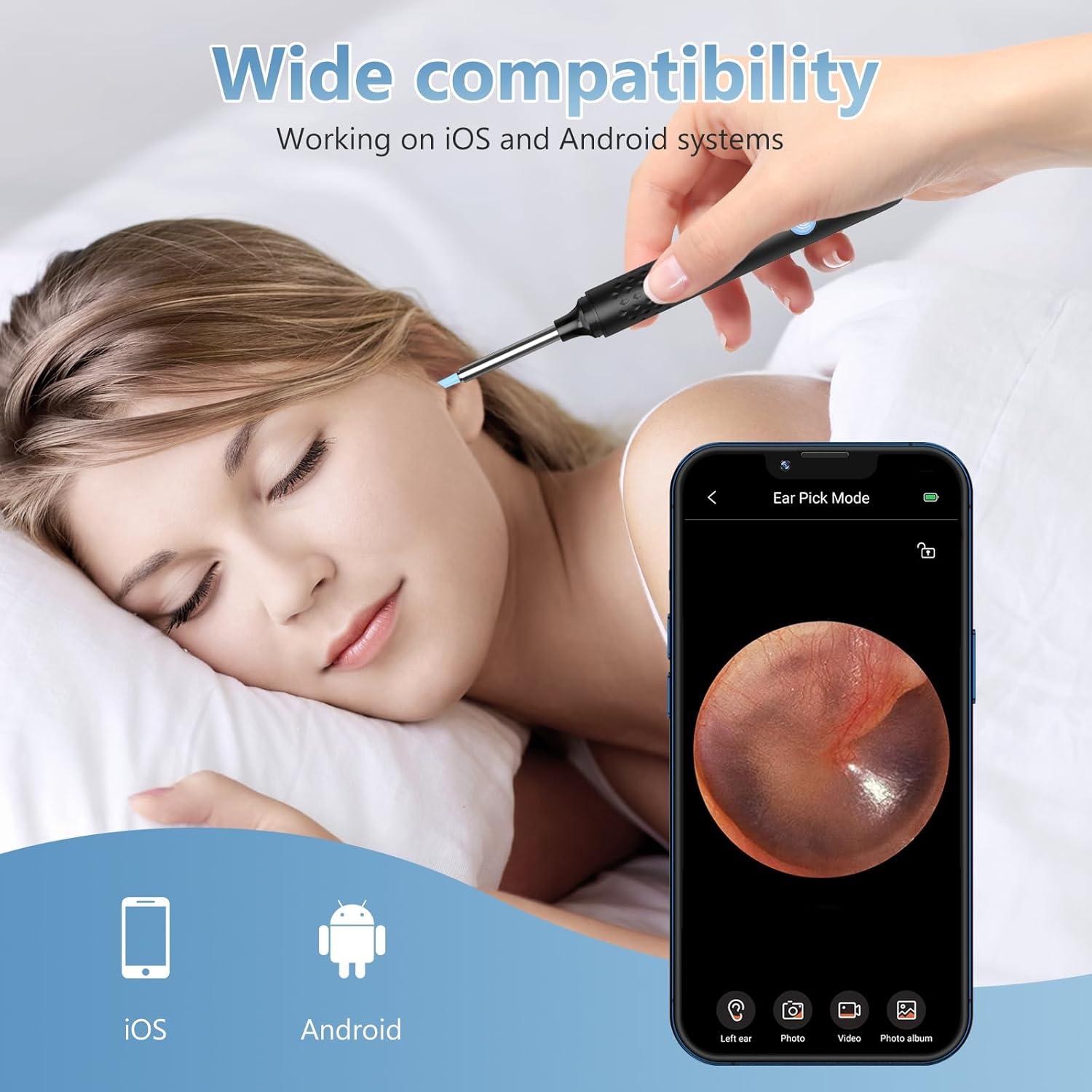 Kit de Eliminación de Cerumen VITCOCO con Cámara 1920P HD