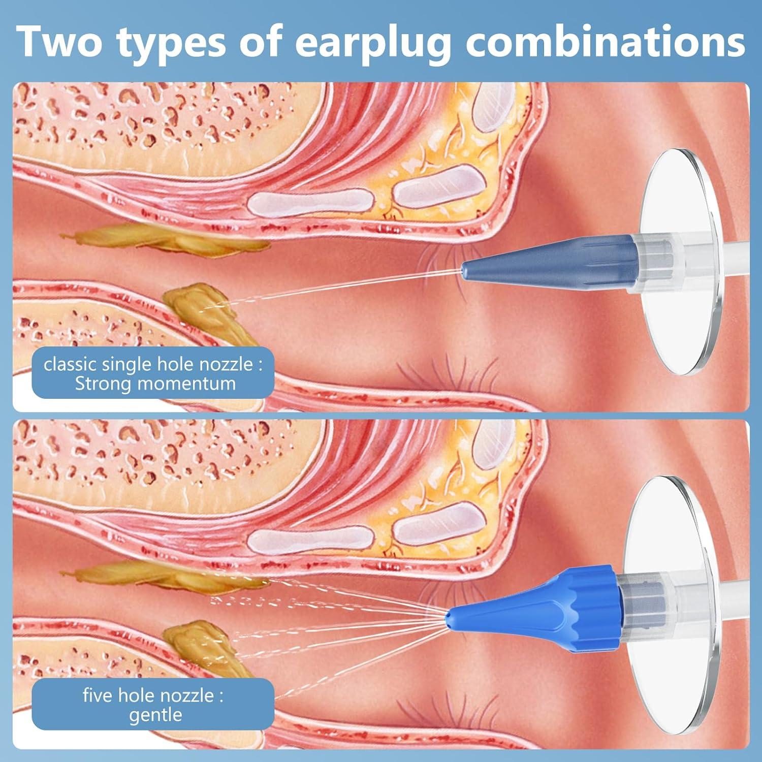 Kit de Eliminación de Cerumen VITCOCO con Cámara 1920P HD