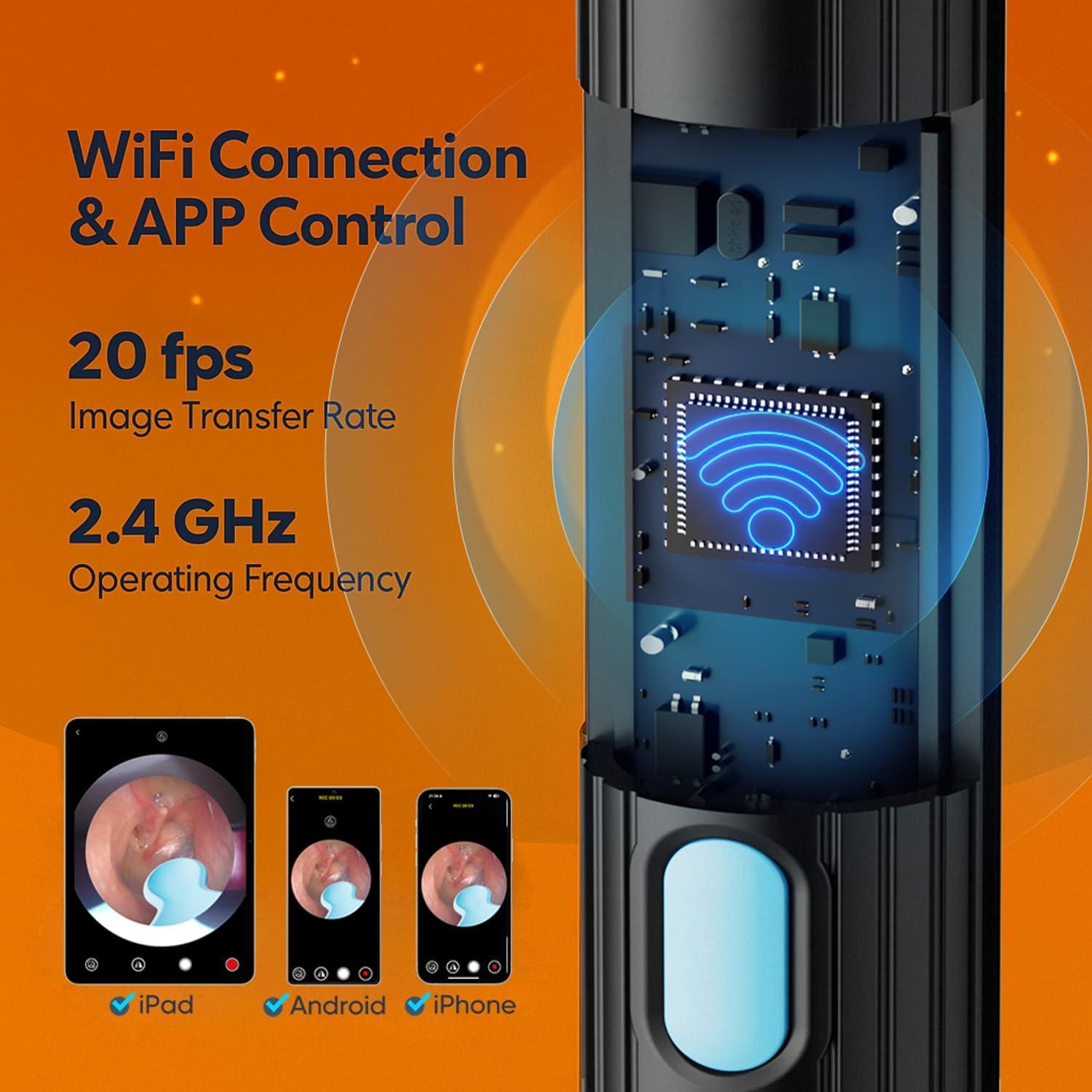 Kit de Limpieza de Oídos Bekhic P6s con Cámara HD 1296P