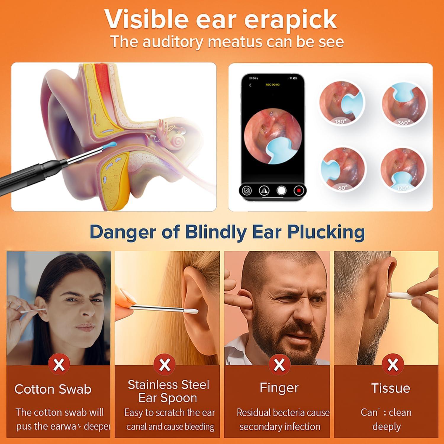 Kit de Limpieza de Oídos Bekhic P6s con Cámara HD 1296P