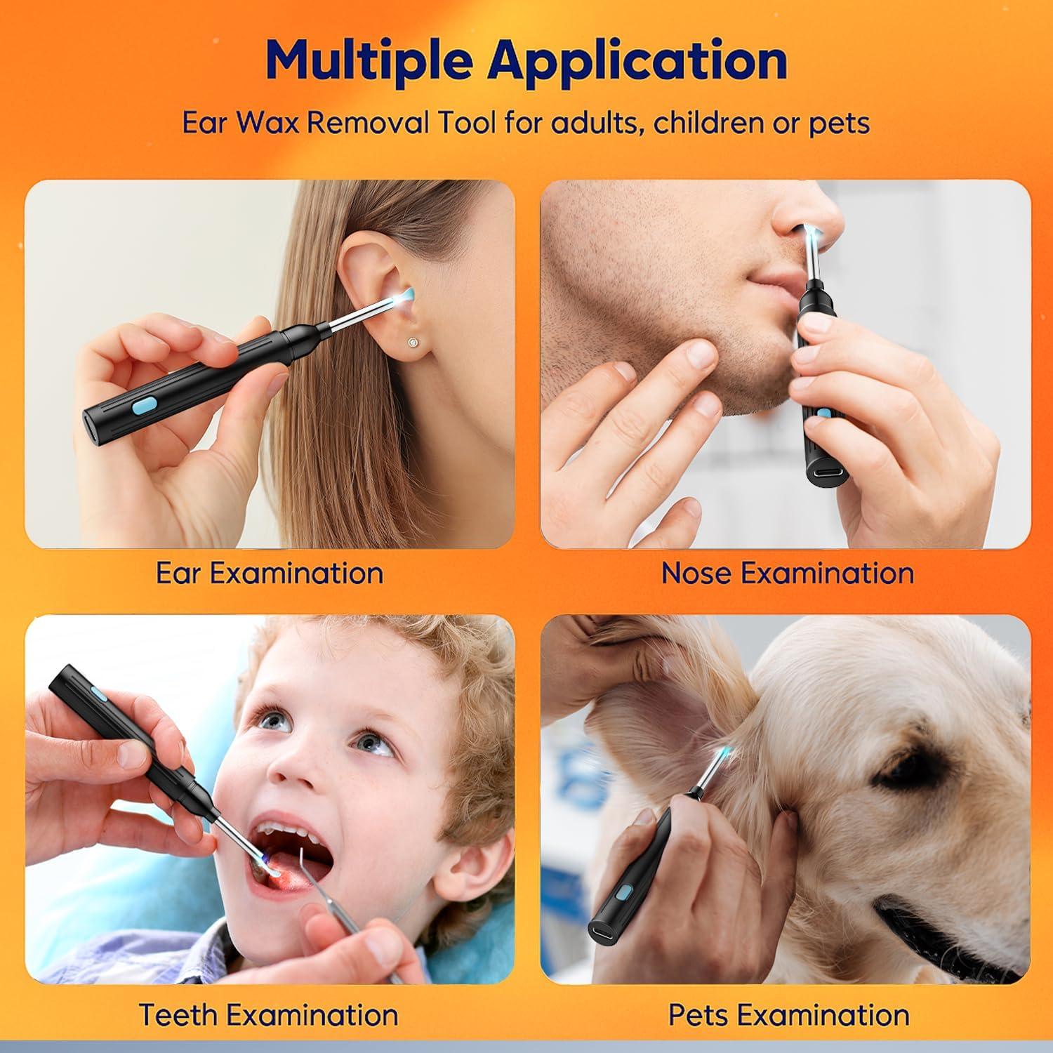 Kit de Limpieza de Oídos Bekhic P6s con Cámara HD 1296P