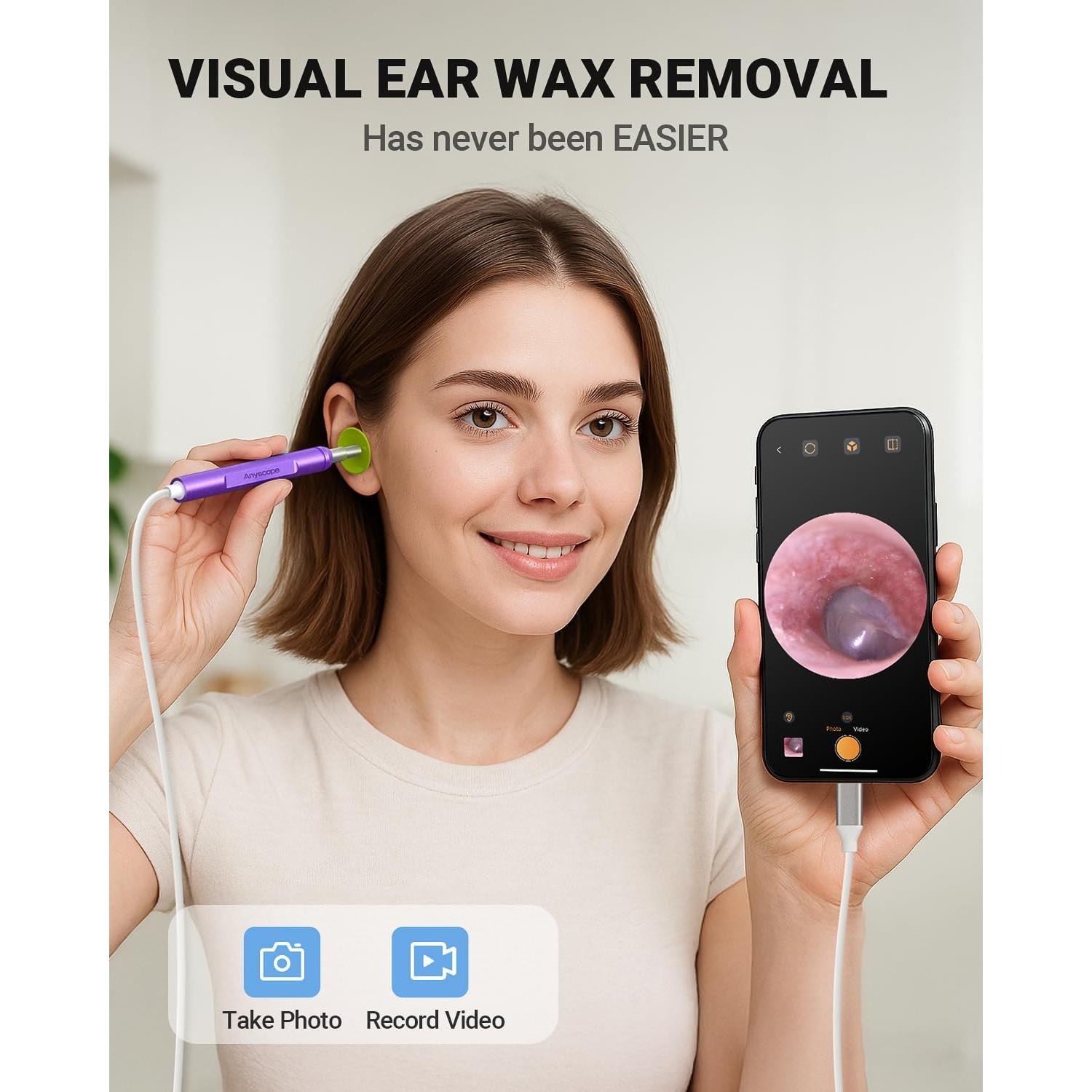 Otoscopio Digital AnyScope HD para Remoción de Cerumen - Púrpura