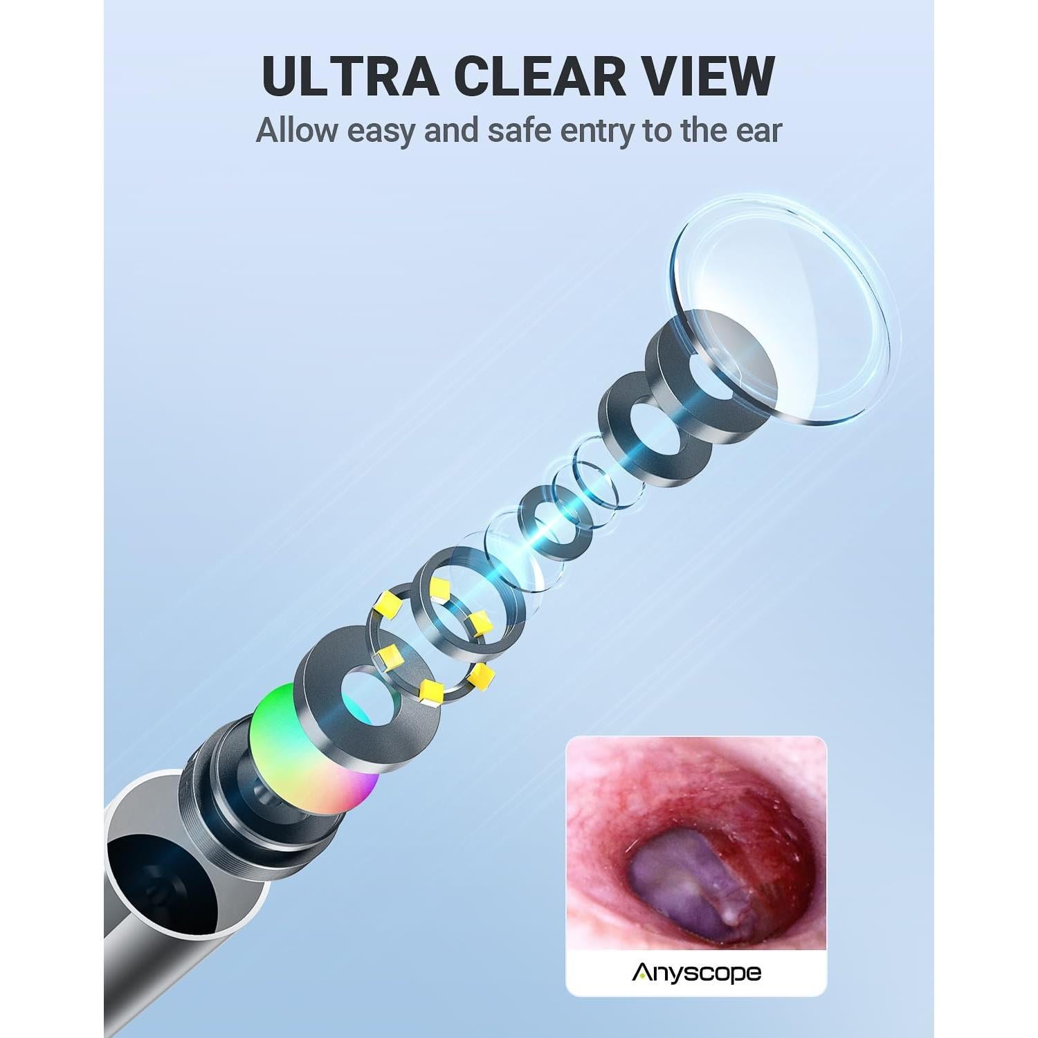 Otoscopio Digital HD AnyScope Plata con Luz y Cámara de Oído