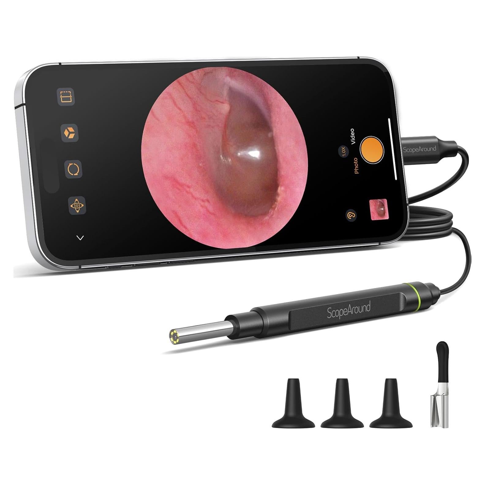 Otoscopio Digital ScopeAround 1080P con Luz LED 3.9mm