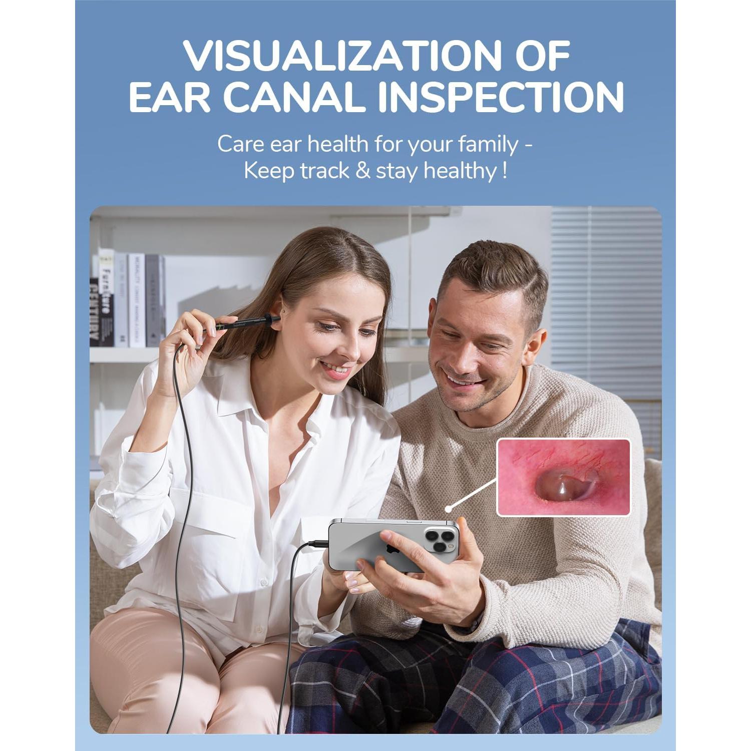 Otoscopio Digital ScopeAround 1080P con Luz LED 3.9mm