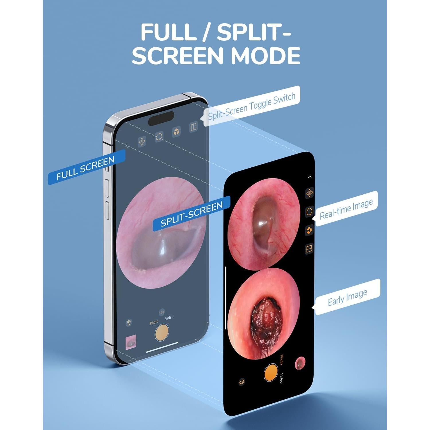 Otoscopio Digital ScopeAround 1080P con Luz LED 3.9mm