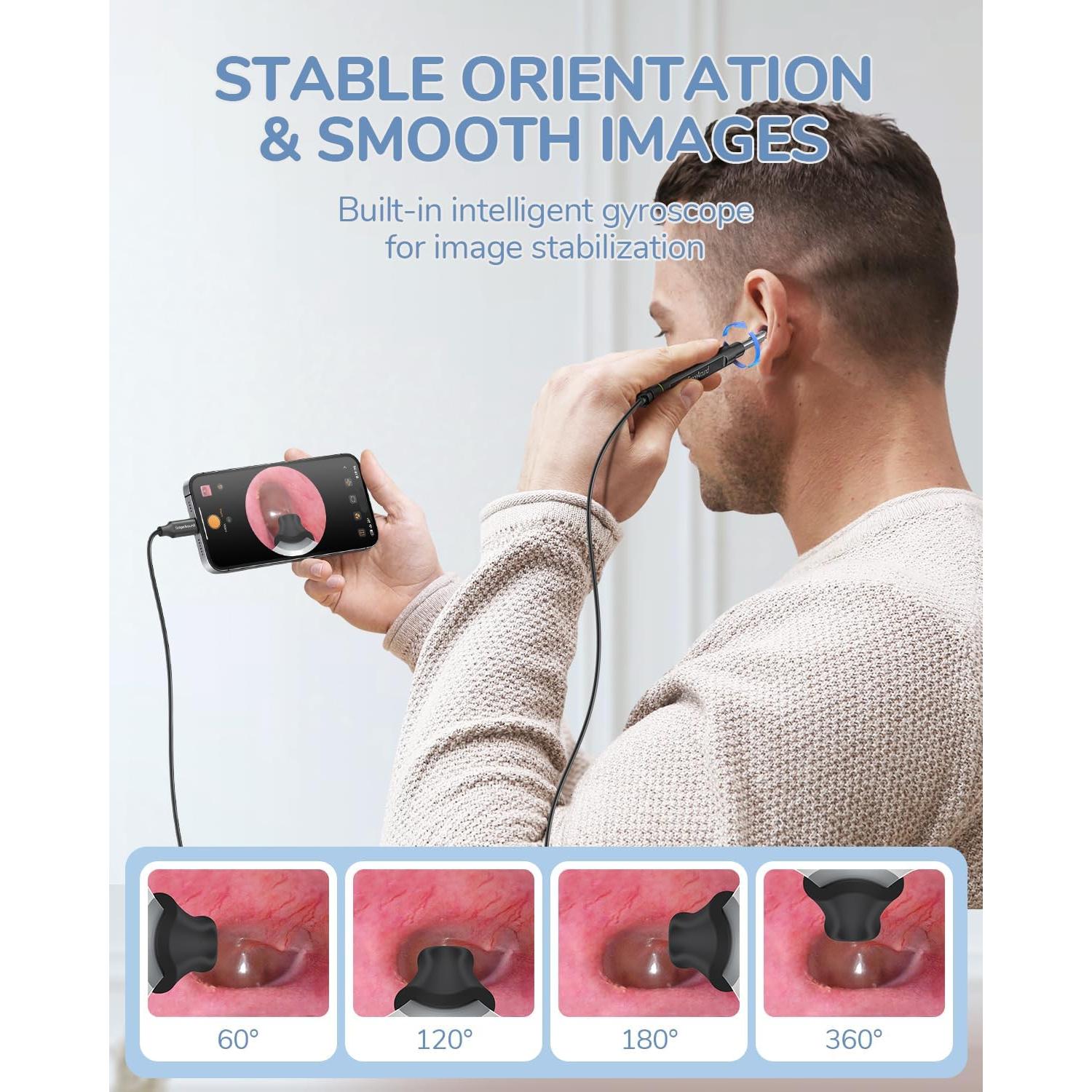 Otoscopio Digital ScopeAround 1080P con Luz LED 3.9mm