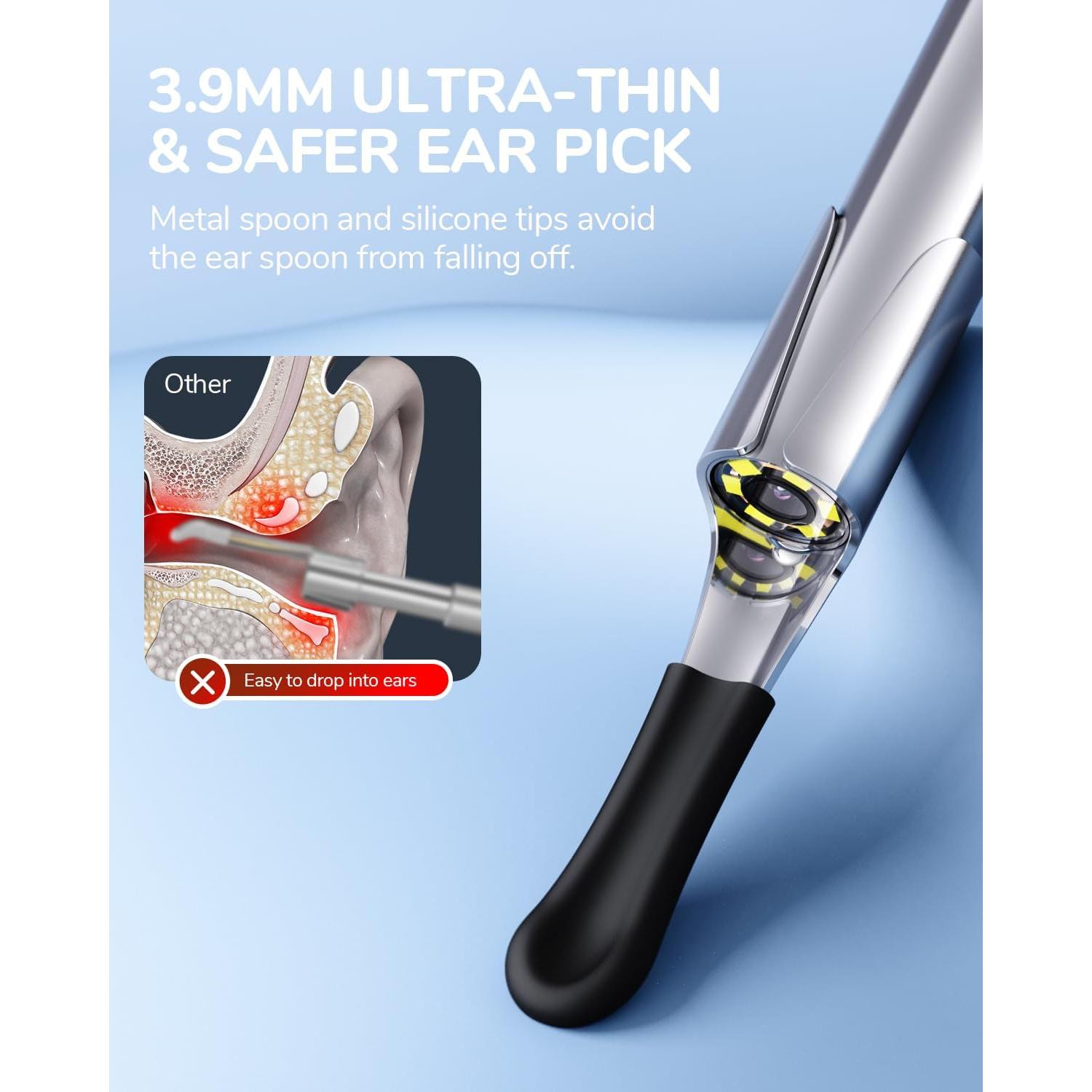 Otoscopio Digital ScopeAround 1080P con Luz LED 3.9mm