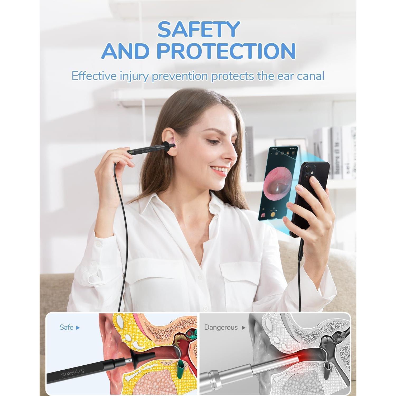 Otoscopio Digital ScopeAround 1080P con Luz LED 3.9mm