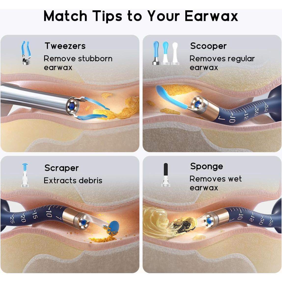 Bebird Earsight Plus Puntas de Reemplazo - Kit de 14 Piezas