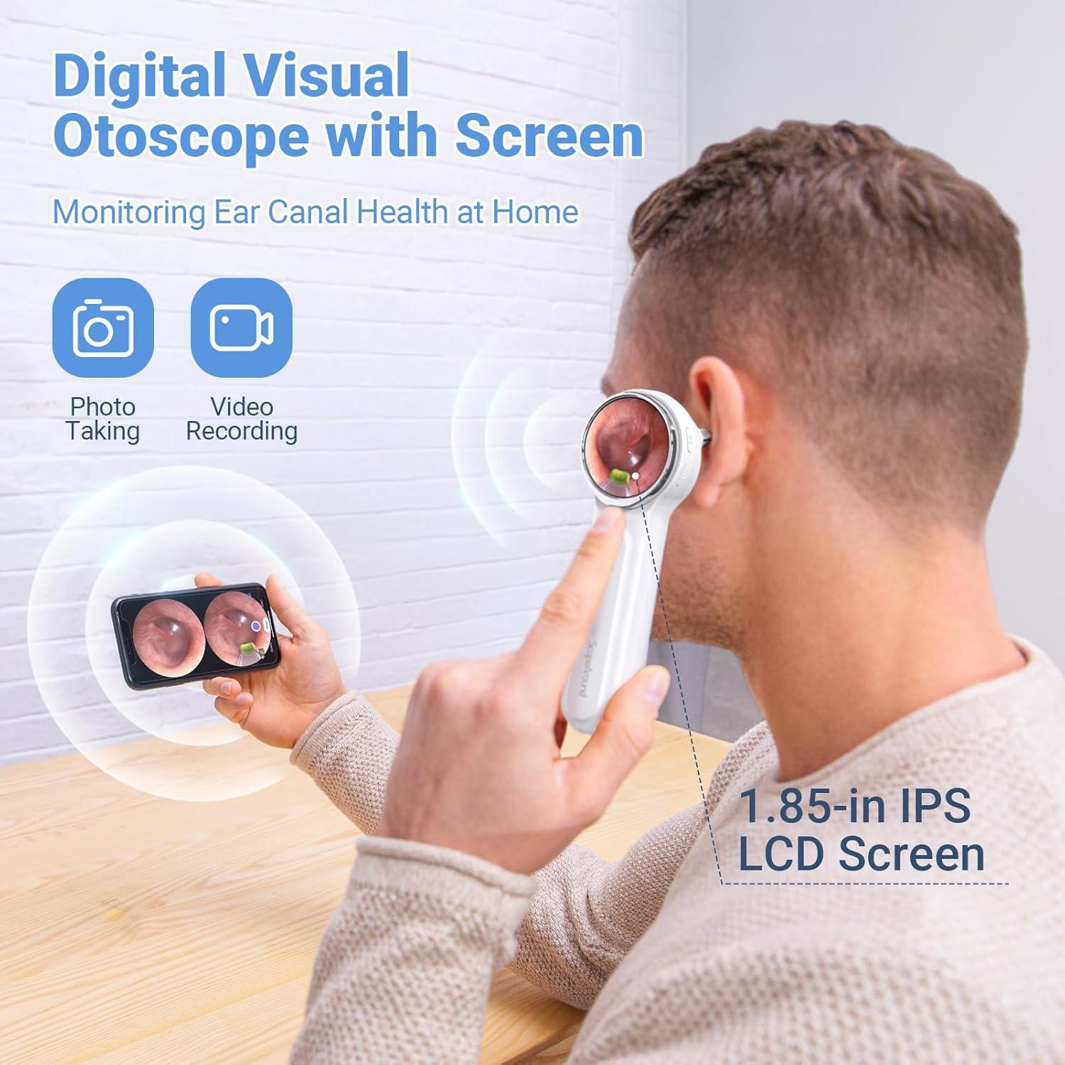 Otoscopio Digital ScopeAround con Pantalla IPS 4.7cm y Luz LED