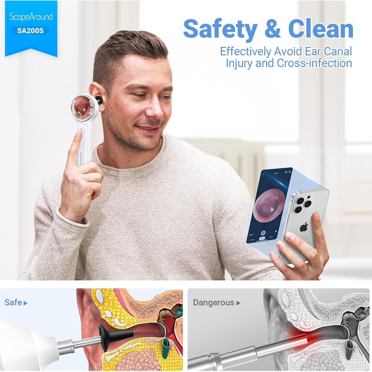 Otoscopio Digital ScopeAround con Pantalla IPS 4.7cm y Luz LED