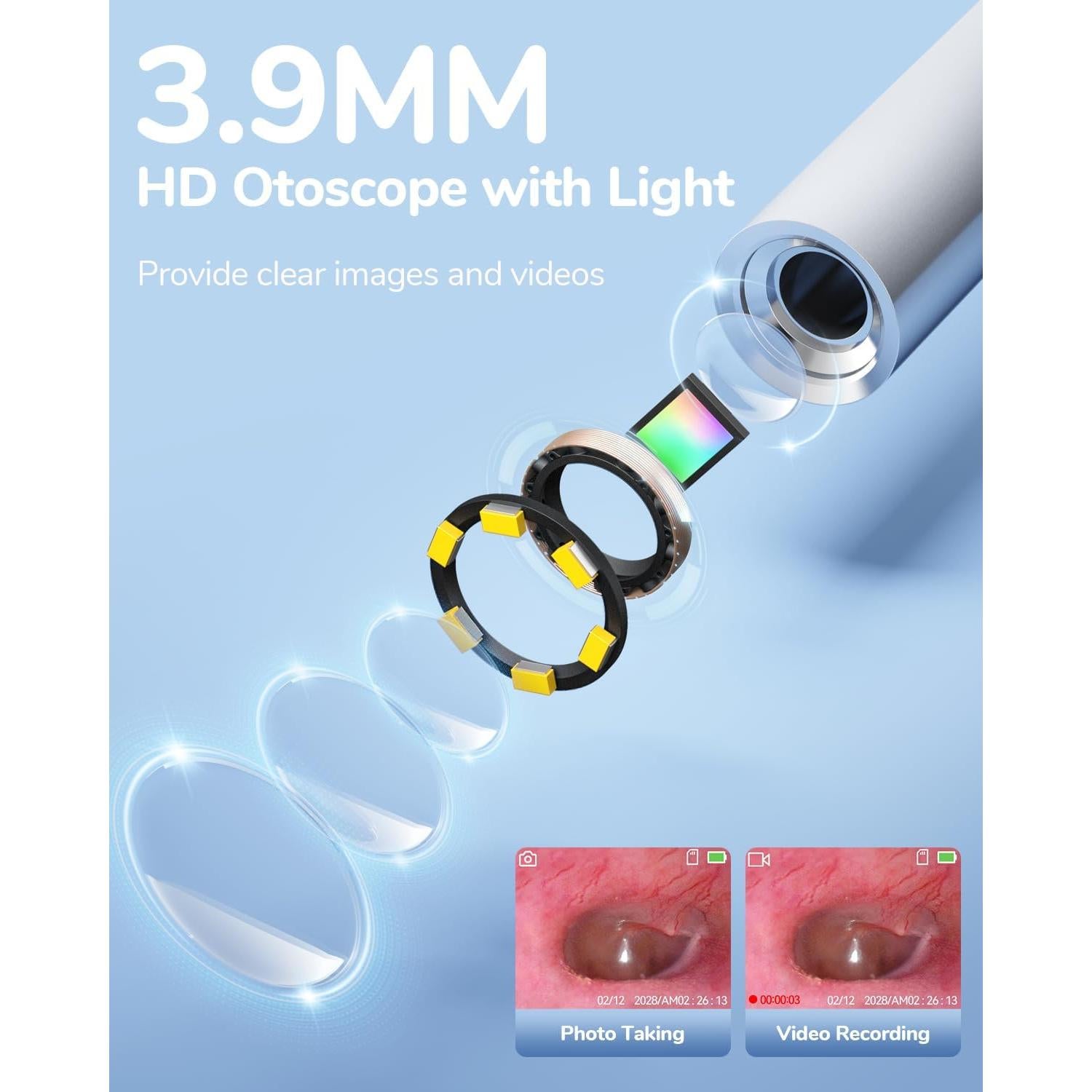 Otoscopio Digital ScopeAround HD 720P con Luz - 3.9mm