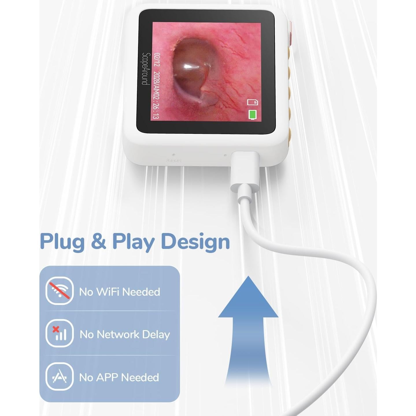 Otoscopio Digital ScopeAround HD 720P con Luz - 3.9mm