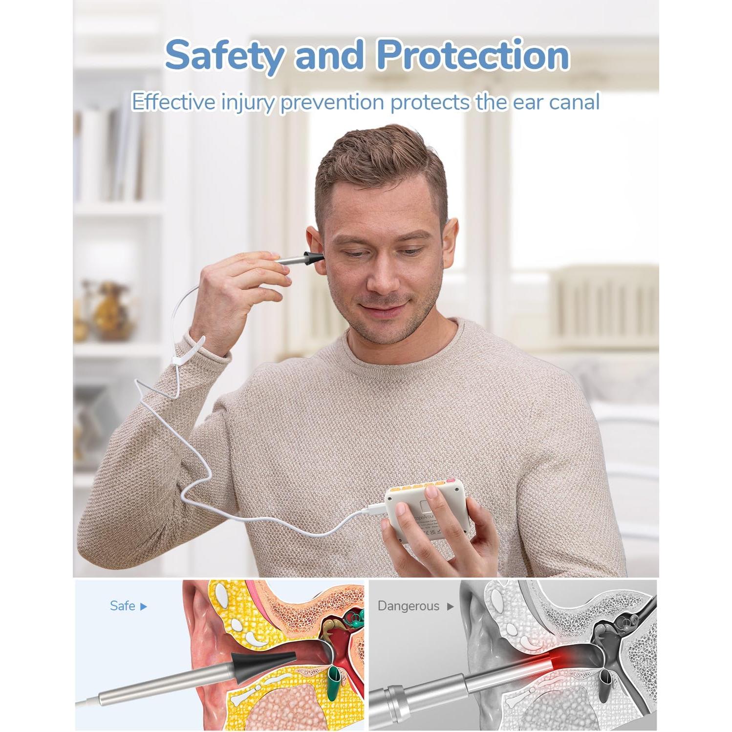 Otoscopio Digital ScopeAround HD 720P con Luz - 3.9mm