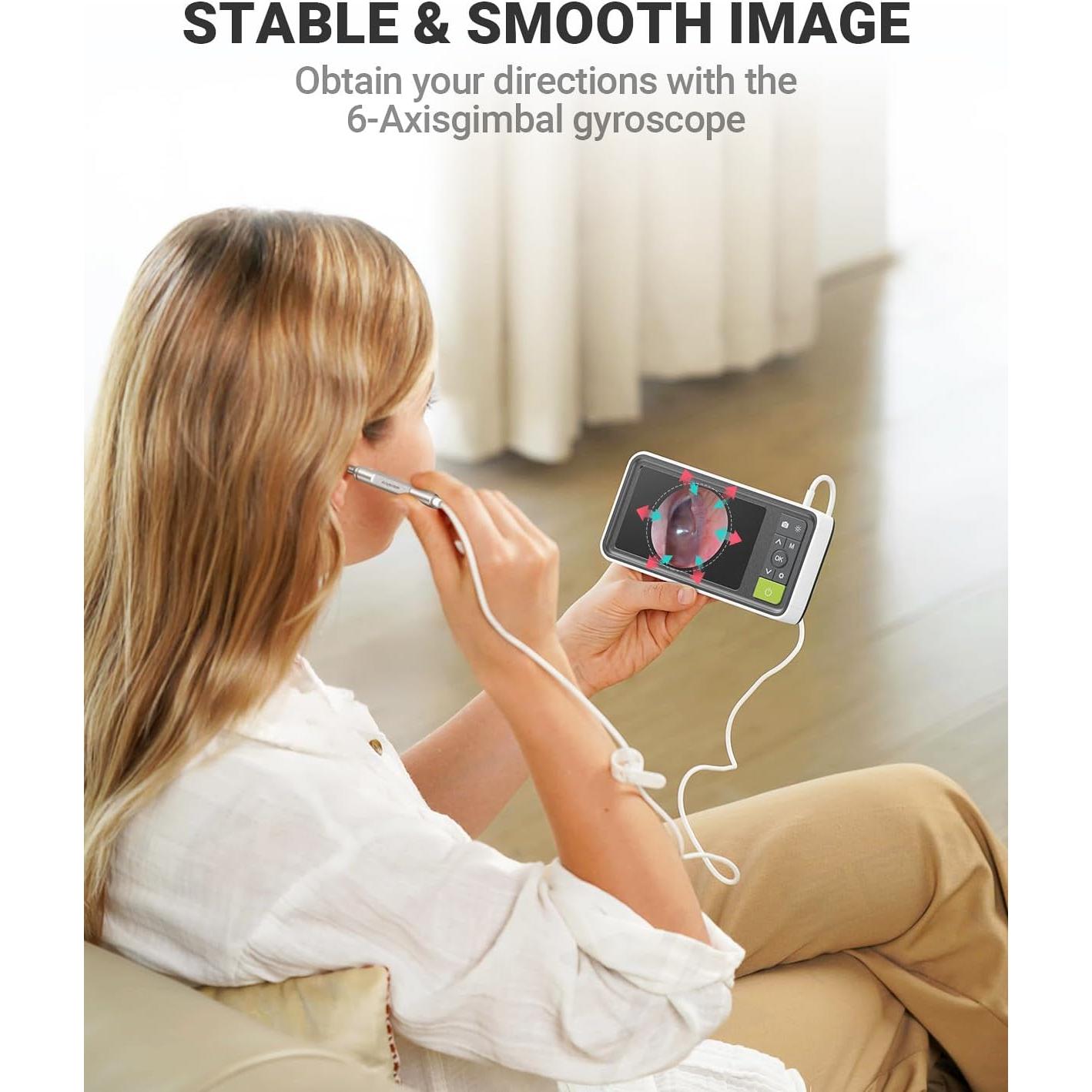 Otoscopio Digital AnyScope 1080P con Pantalla 11.43cm y Luz LED