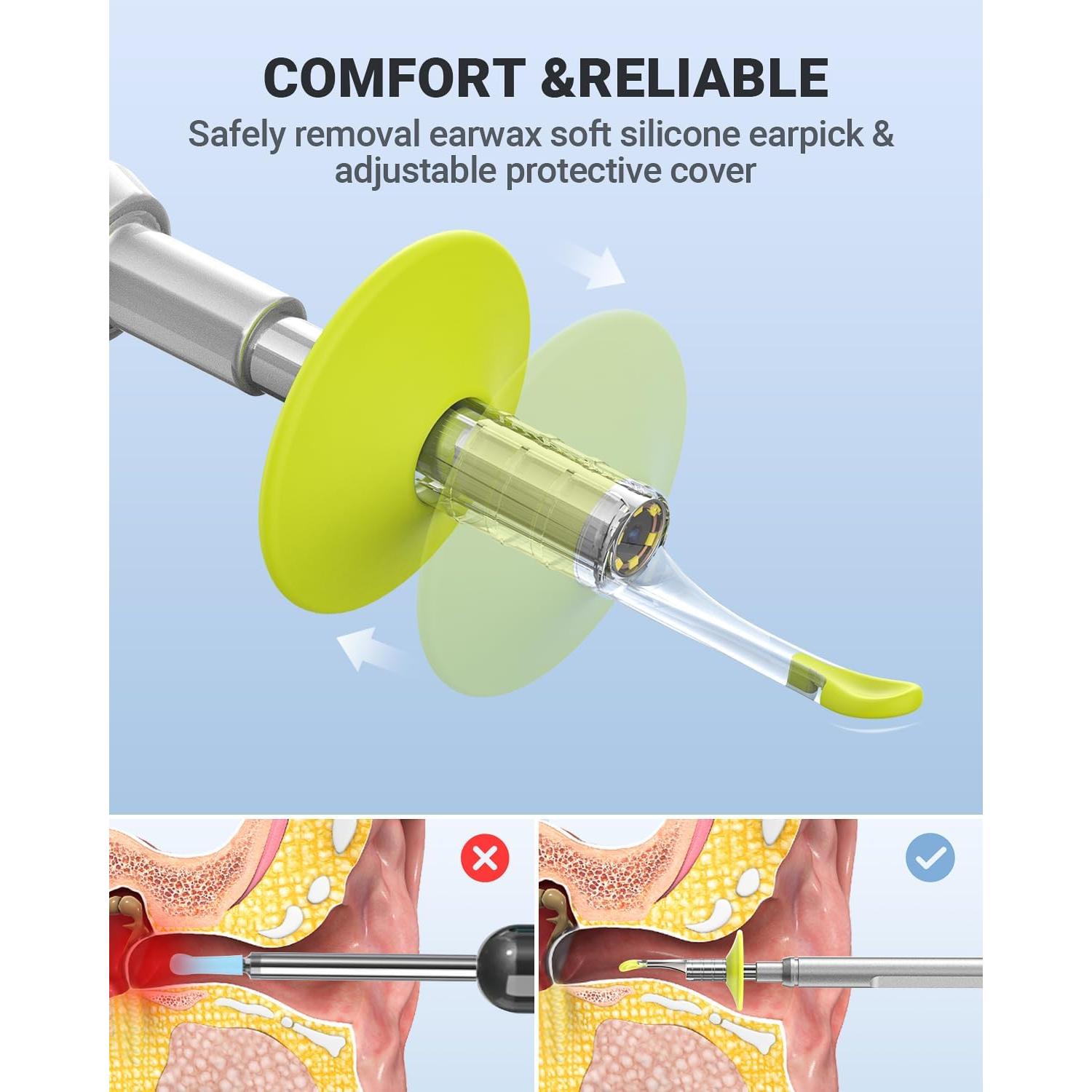 Otoscopio Digital AnyScope 1080P con Pantalla 11.43cm y Luz LED