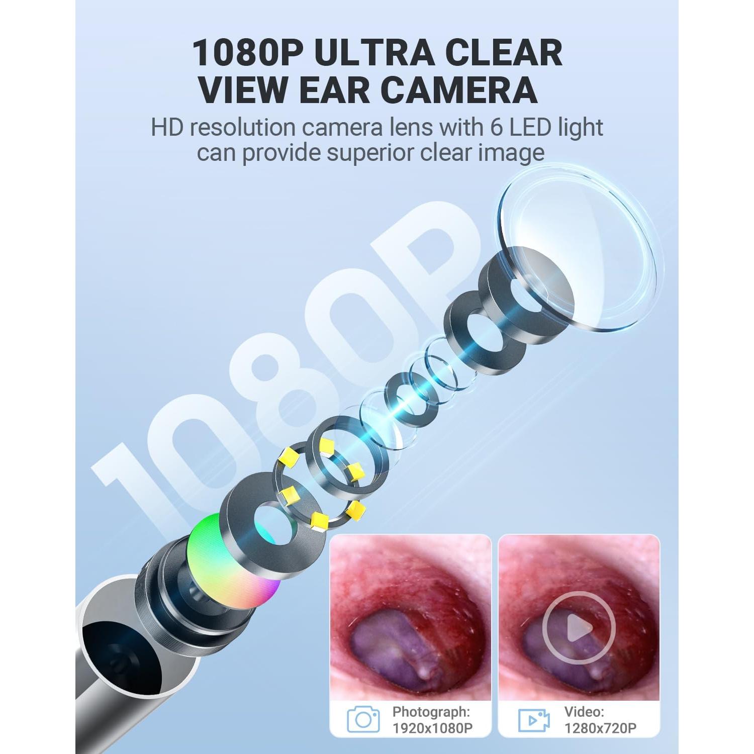 Otoscopio Digital AnyScope 1080P con Pantalla 11.43cm y Luz LED