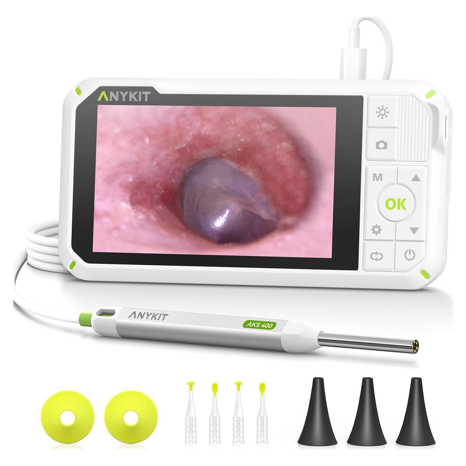 Otoscopio Digital Anykit 4" con Giroscopio y Cámara 3.9mm