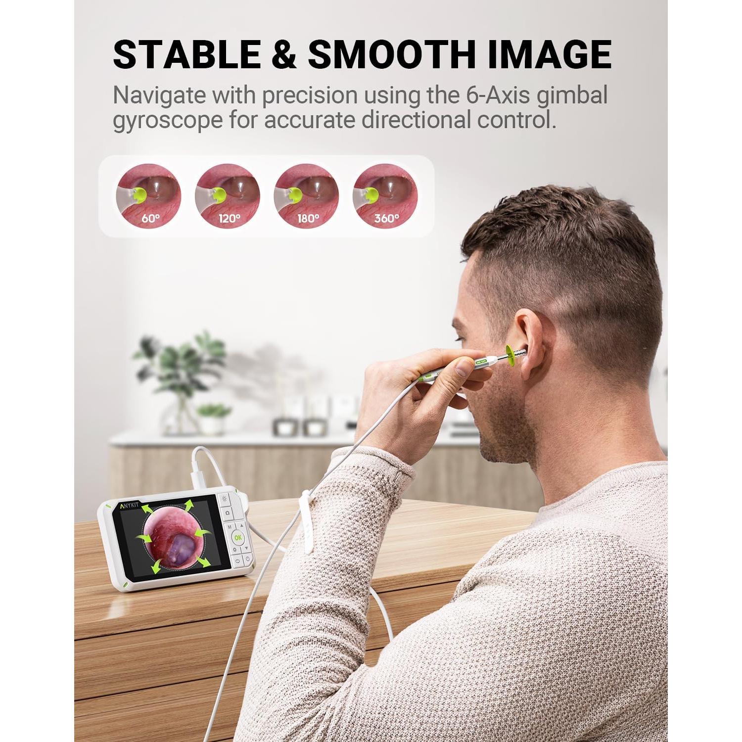 Otoscopio Digital Anykit 4" con Giroscopio y Cámara 3.9mm