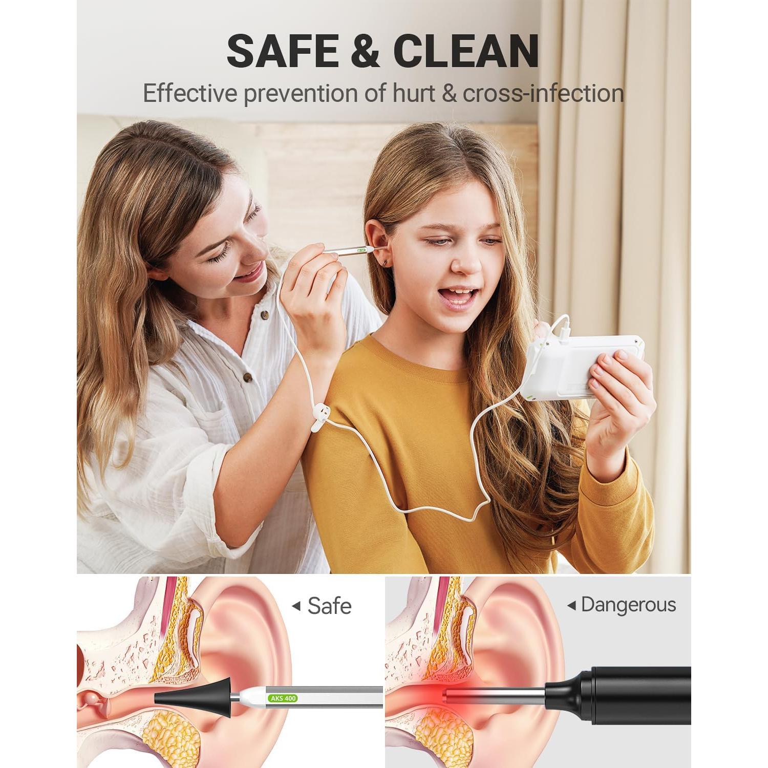 Otoscopio Digital Anykit 4" con Giroscopio y Cámara 3.9mm