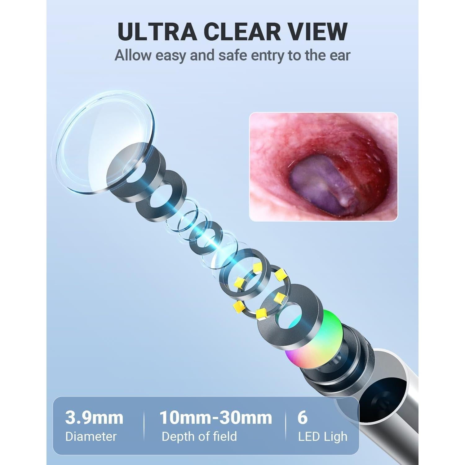 Otoscopio Digital Anykit 4" con Giroscopio y Cámara 3.9mm