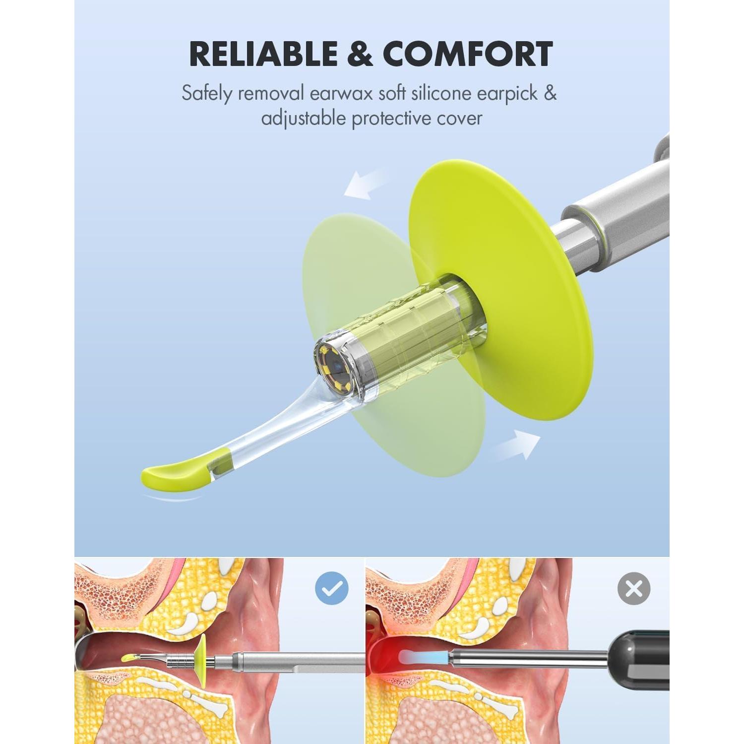 Otoscopio Digital Anykit 4" con Giroscopio y Cámara 3.9mm