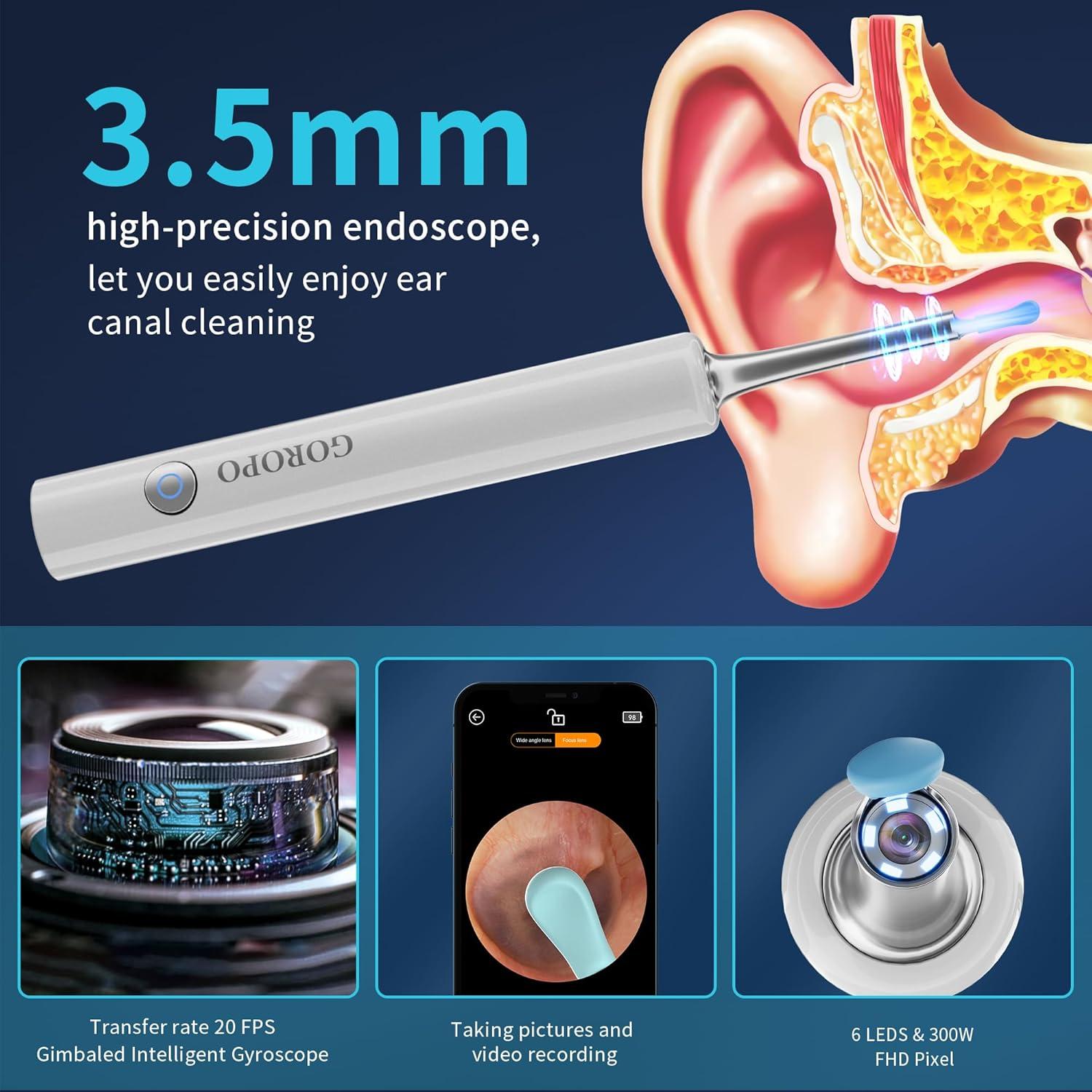 Limpiador de Oído Inalámbrico Goropo con Cámara HD y 4 Puntas