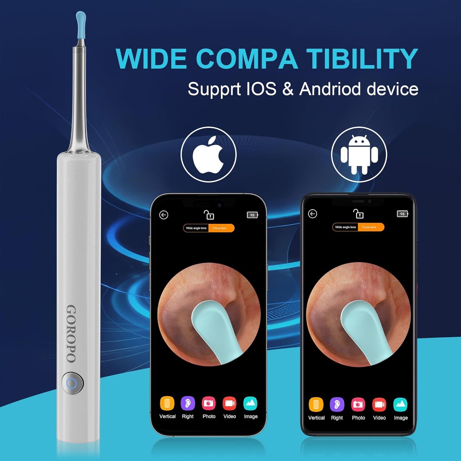 Limpiador de Oído Inalámbrico Goropo con Cámara HD y 4 Puntas