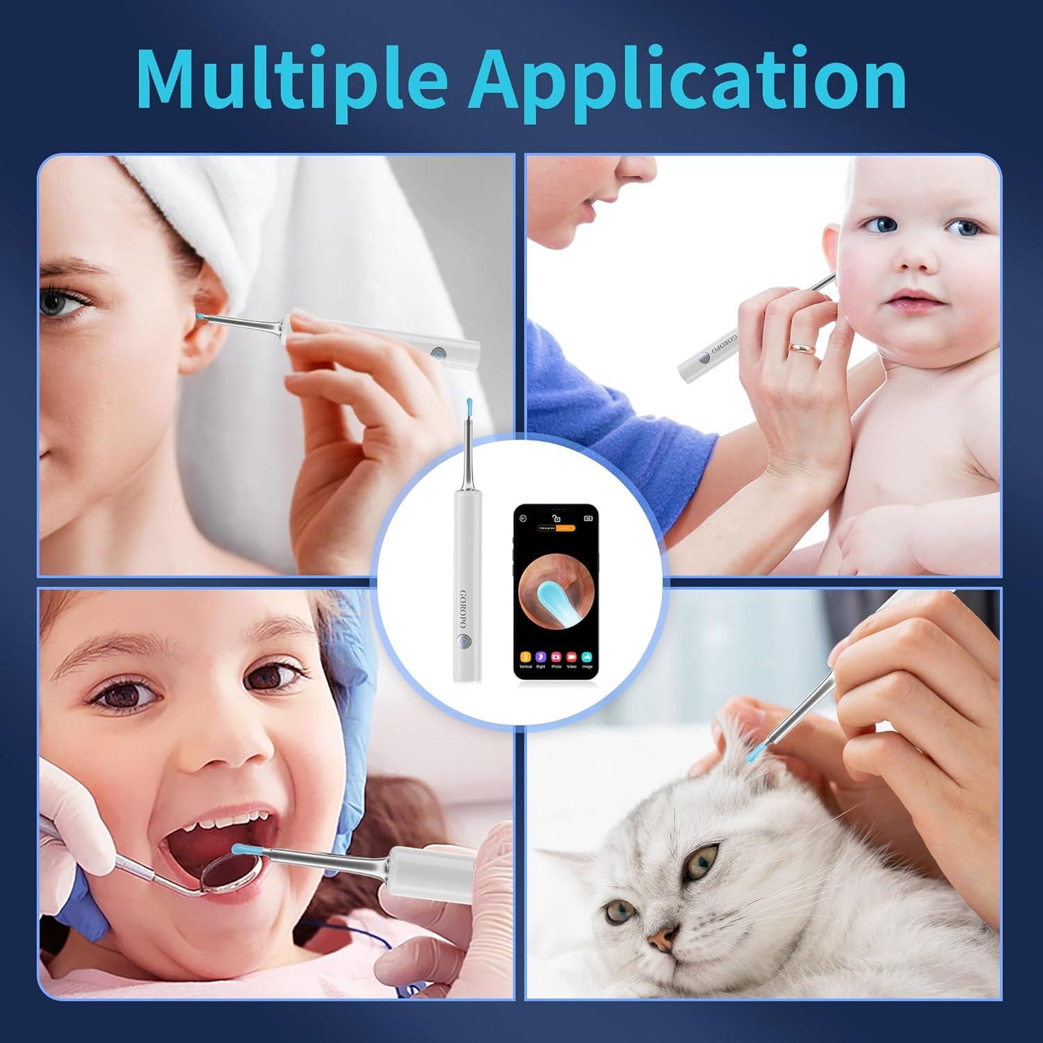 Limpiador de Oído Inalámbrico Goropo con Cámara HD y 4 Puntas