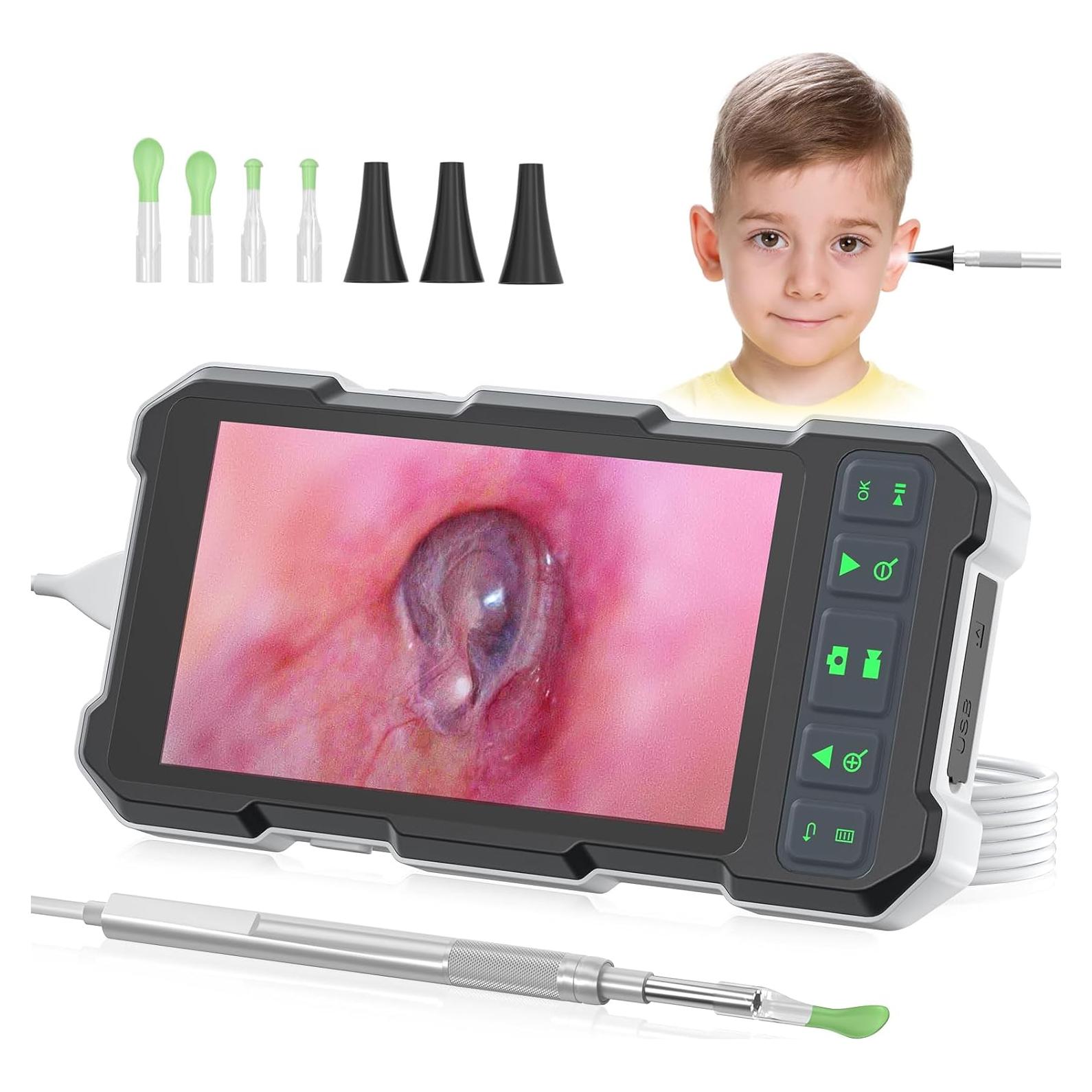Otoscopio Digital QzkBoeo 1080P con Pantalla de 11.43 cm