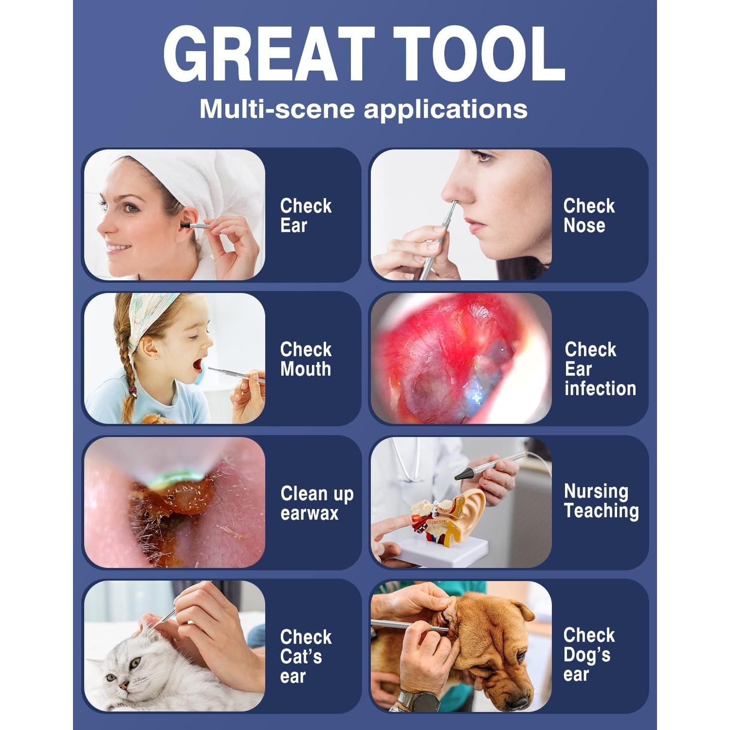 Otoscopio Digital QzkBoeo 1080P con Pantalla de 11.43 cm