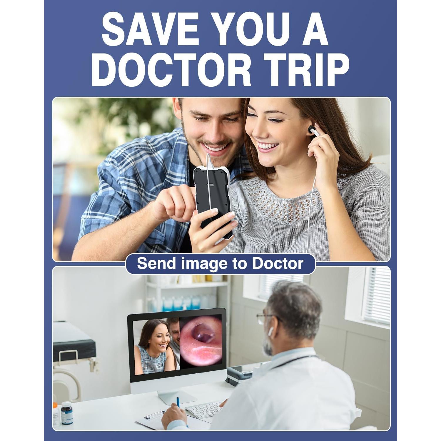 Otoscopio Digital QzkBoeo 1080P con Pantalla de 11.43 cm