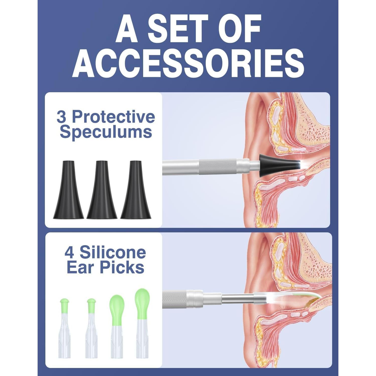 Otoscopio Digital QzkBoeo 1080P con Pantalla de 11.43 cm