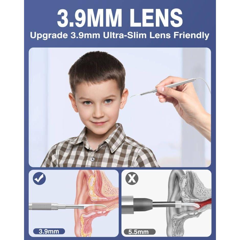 Otoscopio Digital QzkBoeo 1080P con Pantalla de 11.43 cm